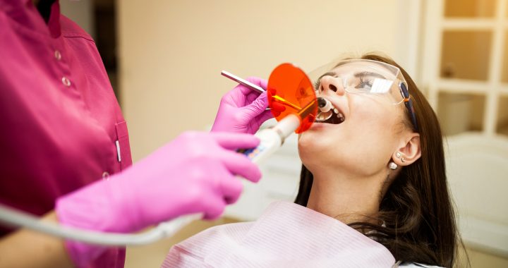 General Dentistry - Tooth-Colored Fillings - Gorgeous Smile Dental Clinic - San Jose and Newark, California